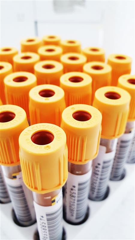 An extreme close up shot of plasma collection vials with orange caps organized in a container.